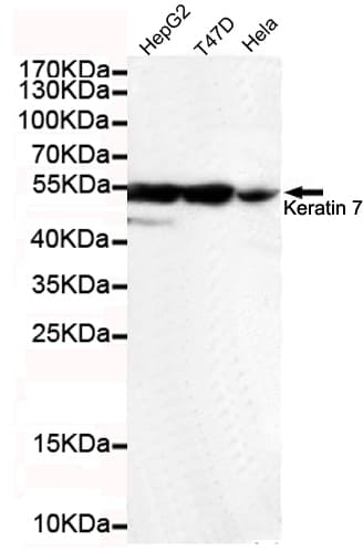 KRT7 / CK7 / Cytokeratin 7 Antibody