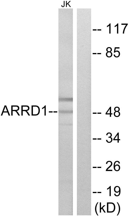 Polyclonal Rabbit anti-Human ARRDC1 Antibody (WB)