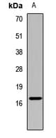 PathPlus™ AIF1 / IBA1 Antibody