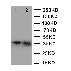 Polyclonal Rabbit anti-Human ANXA10 / Annexin A10 Antibody (aa308-324, IHC, WB)
