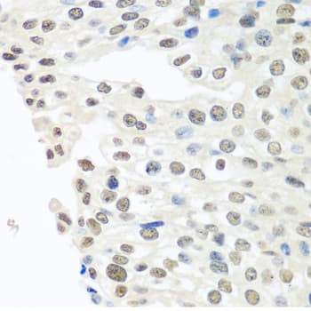 TDP-43 / TARDBP Antibody