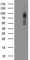 Monoclonal Mouse anti-Human PRKCE / PKC-Epsilon Antibody (clone OTI3F10, IF, WB)