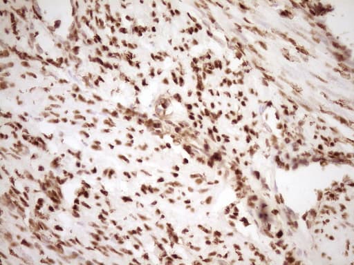 SAE1 Antibody (clone OTI6C7)