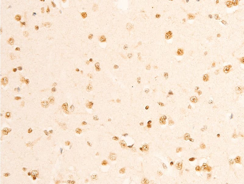 RELA / NFKB p65 Antibody (phospho-Ser536)