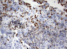 MKI67 / Ki67 Antibody (aa1160-1493, clone OTI15A4)