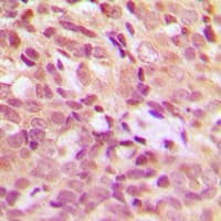 Polyclonal Rabbit anti-Human HSPB1 / HSP27 Antibody (phospho-Ser15, IHC, WB)