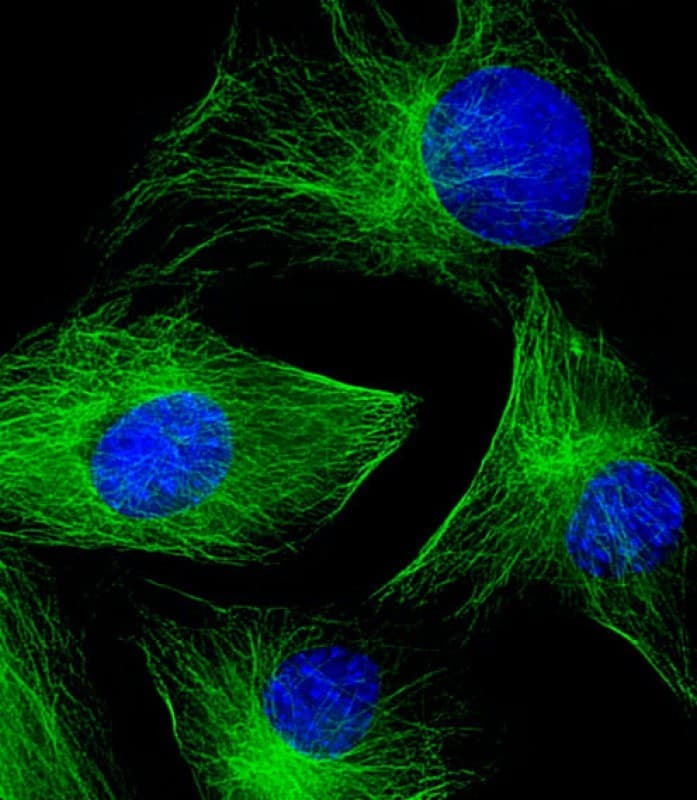 TUBB2A / Tubulin Beta 2A Antibody