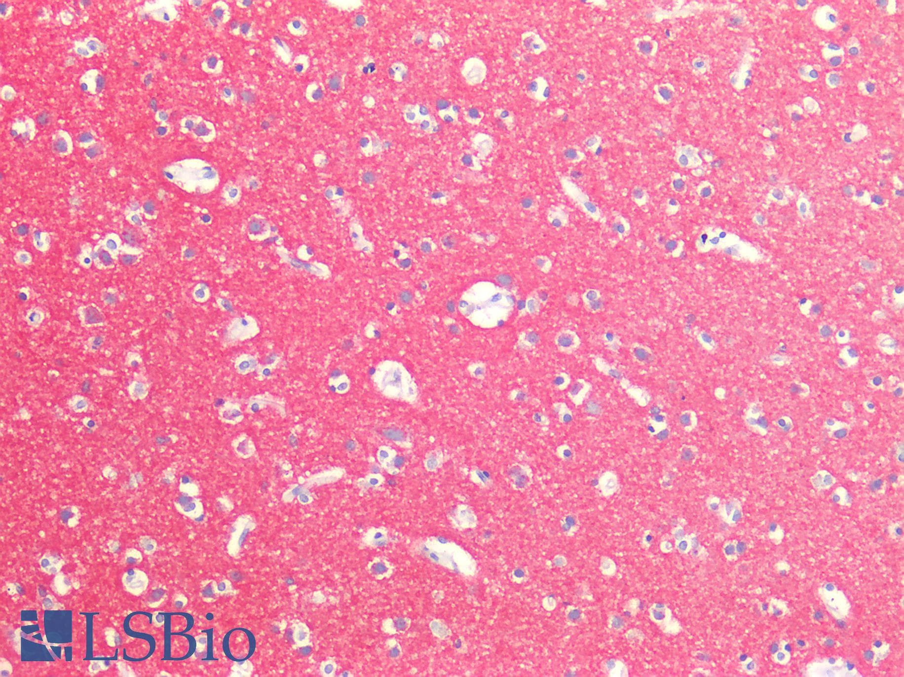 PathPlus™ SNAP25 Antibody