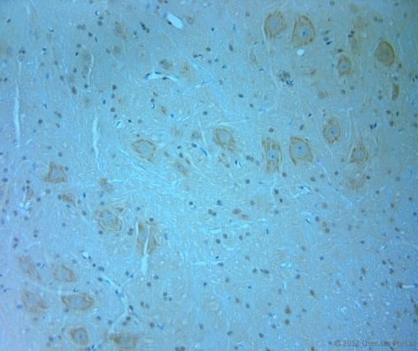 MAGI2 / AIP-1 Antibody (aa1050-1100)