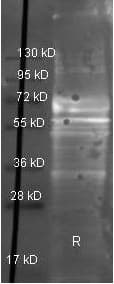 FGA / Fibrinogen Alpha Antibody (Lyophilized, Biotin)