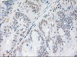 NOG / Noggin Antibody (clone OTI1C1)