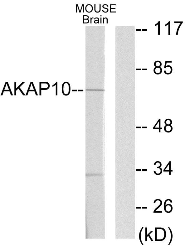 Polyclonal Rabbit anti-Human AKAP10 Antibody (WB)