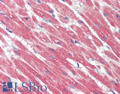IHC-plus™ PPP1R3B Antibody