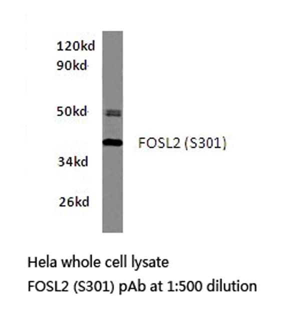 FOSL2 / FRA-2 Antibody (Ser301)