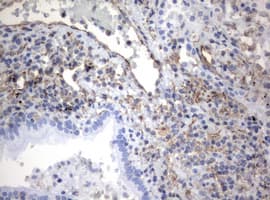 Monoclonal Mouse anti-Human Vimentin Antibody (clone OTI5D7, IHC, WB)