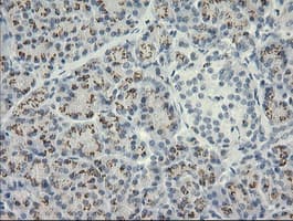 HSPA8 / HSC70 Antibody (clone OTI1H3)