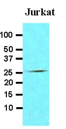 FADD Antibody (aa1-208, clone J1D2)