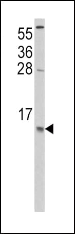 IHC-plus™ CCL2 / MCP1 Antibody (aa62-89)