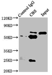 Polyclonal Rabbit anti-Human CBS Antibody (IHC, IF, WB)