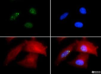 TP53BP1 / 53BP1 Antibody (Biotin)