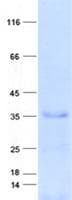 Human C10orf120 Protein (Recombinant His, N-Terminal)