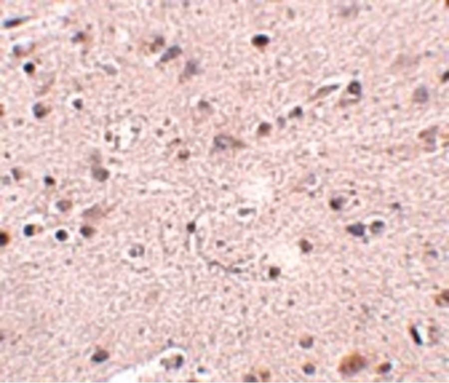 MC4R / Melanocortin 4 Receptor Antibody
