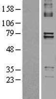 Human PTCD1 Protein (Over-Expression Lysate Myc-DDK (Flag))
