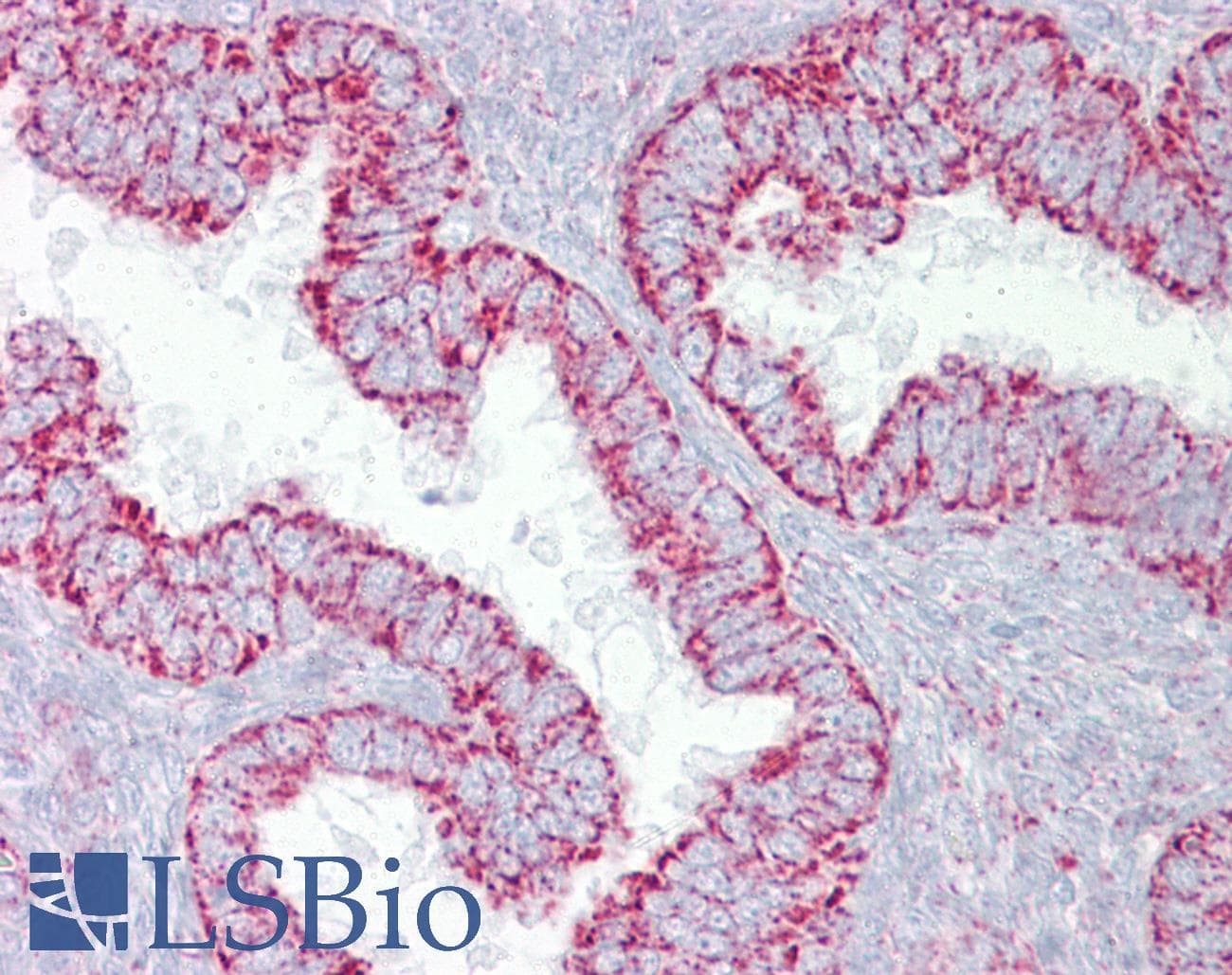 PDGF-BB Antibody (N-Terminus, HRP)