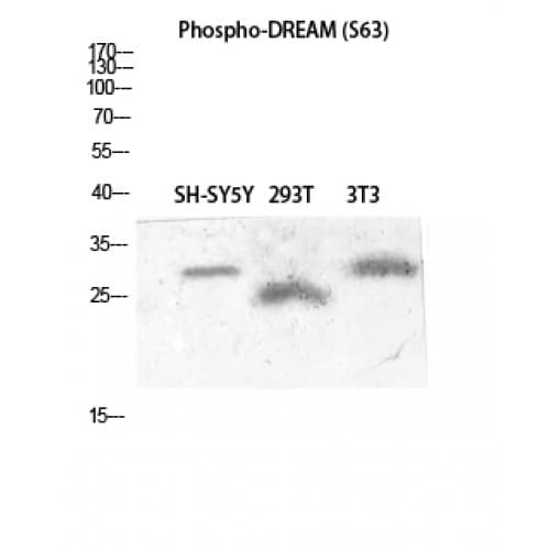 KCNIP3 / Dream / Calsenilin Antibody (40-120 aa)