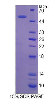 Human ARHGDIB / D4 GDI Protein (Recombinant His-GST)