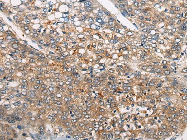 Polyclonal Rabbit anti-Human CDKL4 Antibody (IHC, WB)