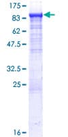Human GPCPD1 Protein (Recombinant GST)