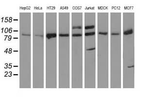 PRKD2 / PKD2 Antibody (clone OTI3F7)