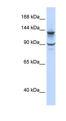 Polyclonal Rabbit anti-Human PGBD1 Antibody (N-Terminus, WB)