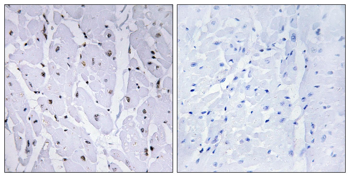 MYB / c-Myb Antibody (phospho-Ser12)