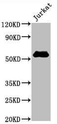 Recombinant Monoclonal Rabbit anti-Human CD4 Antibody (IHC, WB)