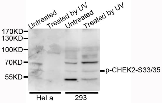 CHEK2 / CHK2 Antibody (phospho-Ser33/35)