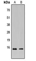 KCNE5 Antibody (Internal)