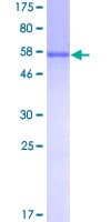 Human ITPK1 Protein (Recombinant GST)