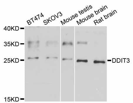 IHC-plus™ Polyclonal Rabbit anti-Human DDIT3 / CHOP Antibody (IHC, IF, WB)