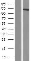 DIAPH2 Protein (Over-Expression Lysate Myc-DDK (Flag))