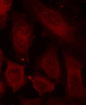 DOK2 Antibody (phospho-Tyr299)
