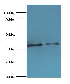 IHC-plus™ Polyclonal Rabbit anti-Human CTSV / Cathepsin V Antibody (aa105-334, IHC, WB)