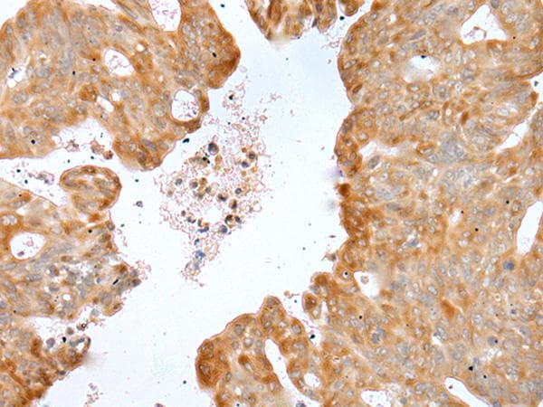Polyclonal Rabbit anti-Human P2RY4 / P2Y4 Antibody (IHC)
