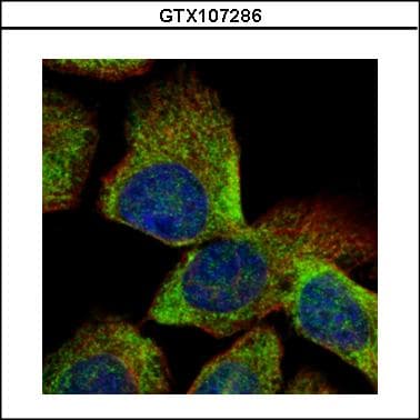 IHC-plus™ VTA1 Antibody (aa1-276)