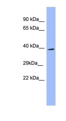 Polyclonal Rabbit anti-Human SH3GL2 Antibody (aa71-120, WB)