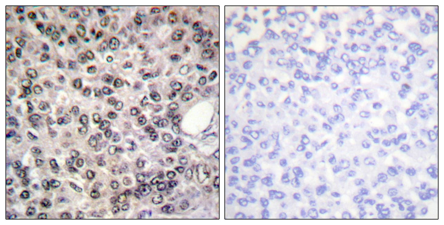 DDX5 Antibody (phospho-Tyr593)