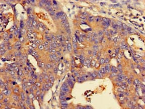 Polyclonal Rabbit anti-Human NMI Antibody (IHC, IF, WB)