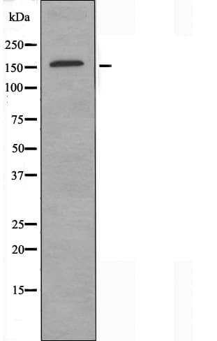 Polyclonal Rabbit anti-Human CEP170 Antibody (IHC, IF, WB)