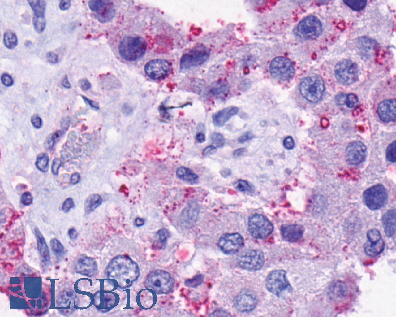 PathPlus™ TACR2 / NK2R Antibody (C-Terminus)
